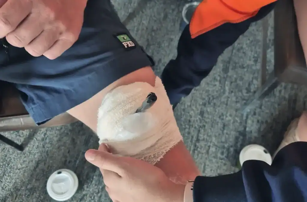 Emergency pen impaled in cyclist's leg during accident.